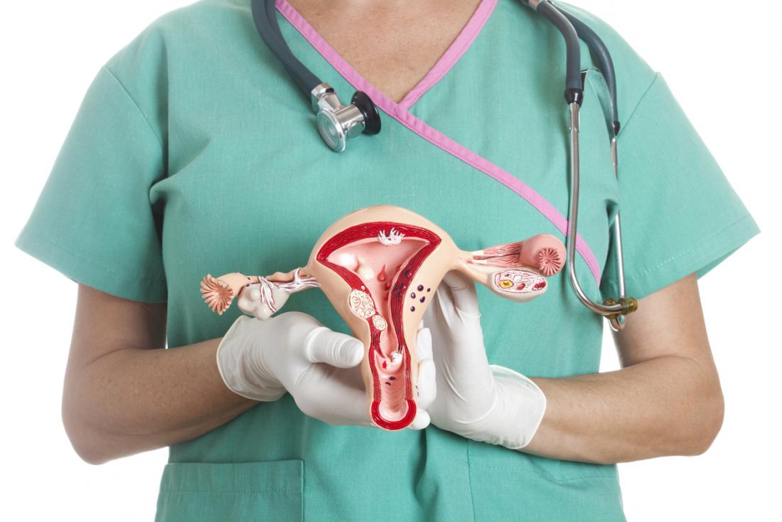 PCOS: What Should You Know About It? Is There Any Sign?